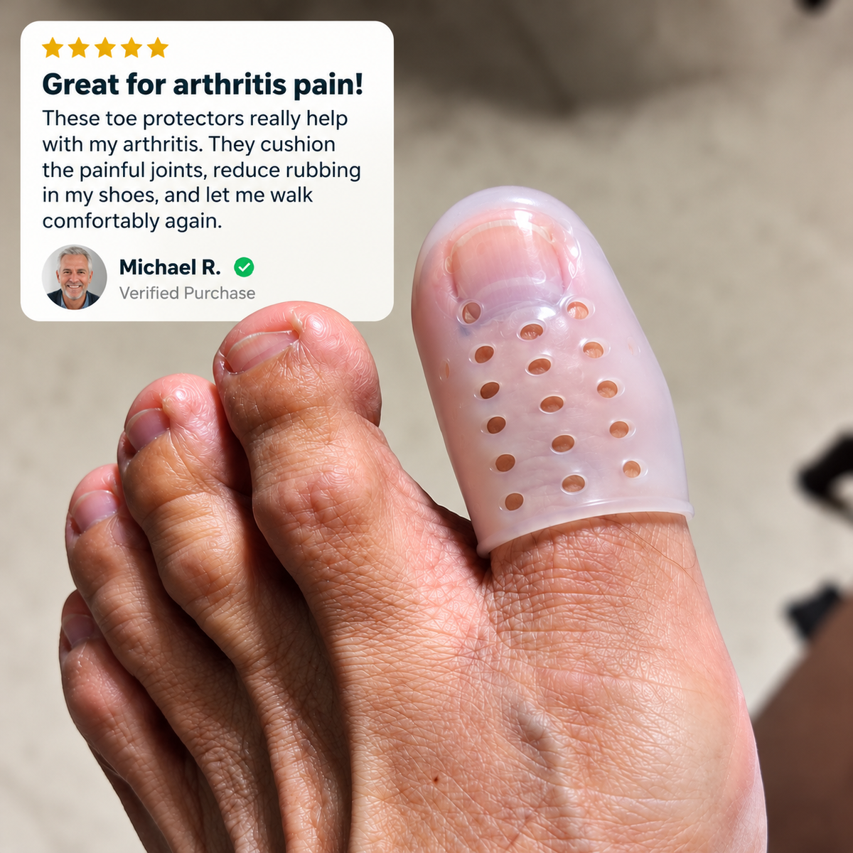 ComfortGuard™ – Gel Toe Protectors for Arthritis Toes