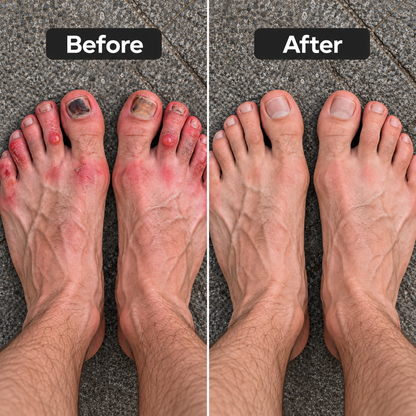 RunGuard™ Toe Protectors